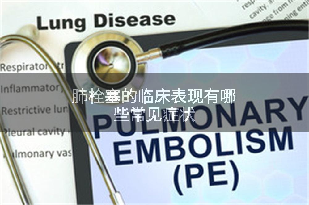 肺栓塞的临床表现有哪些常见症状