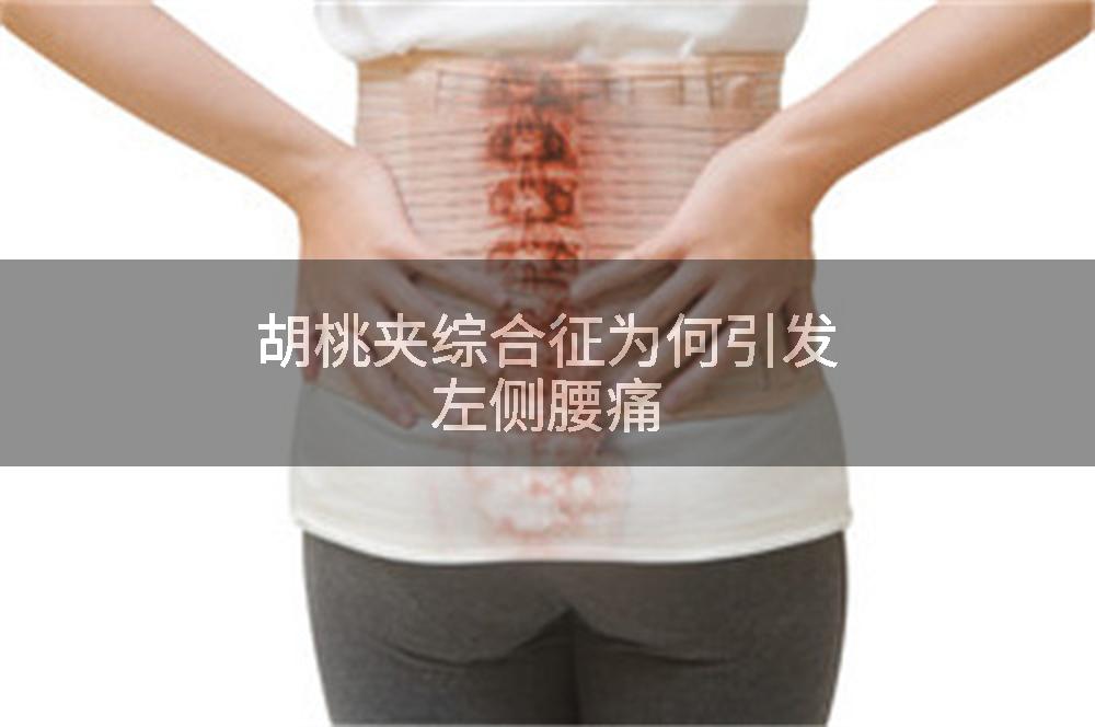 胡桃夹综合征为何引发左侧腰痛