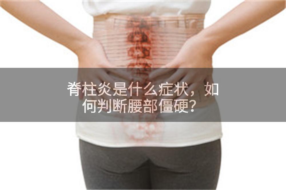 脊柱炎是什么症状，如何判断腰部僵硬？