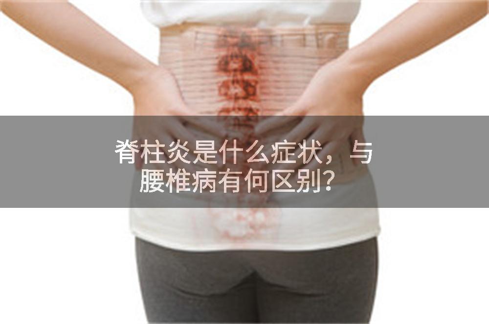 脊柱炎是什么症状，与腰椎病有何区别？