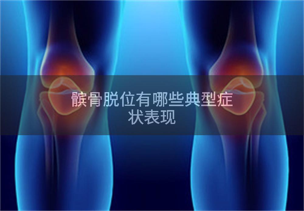 髌骨脱位有哪些典型症状表现