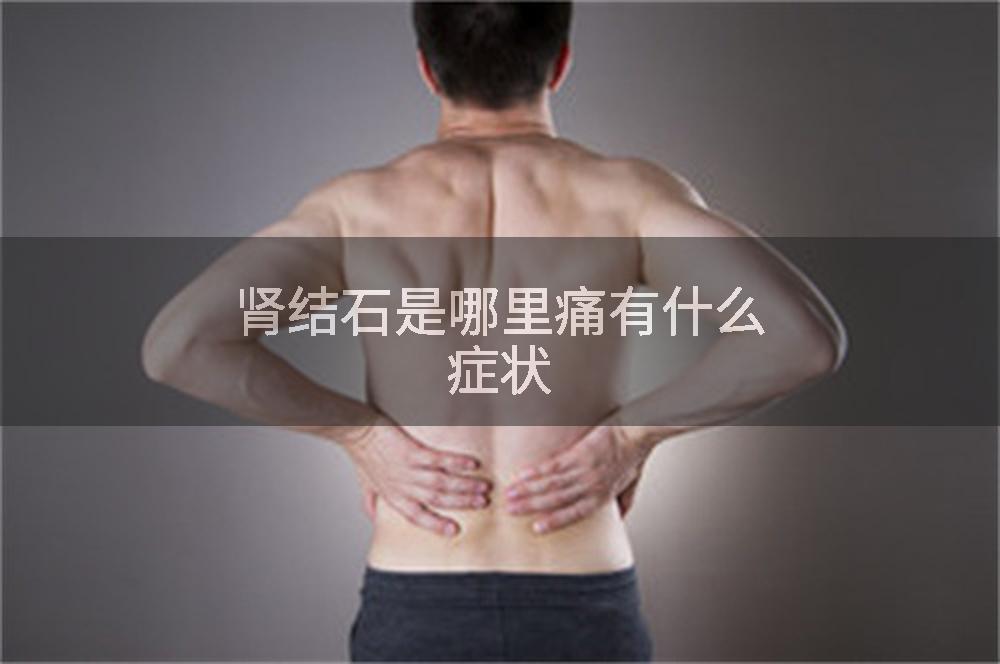 肾结石是哪里痛有什么症状