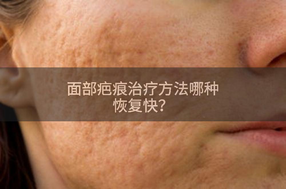 面部疤痕治疗方法哪种恢复快？