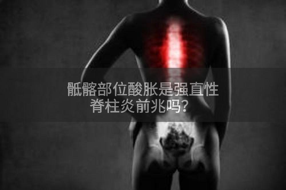 骶髂部位酸胀是强直性脊柱炎前兆吗？