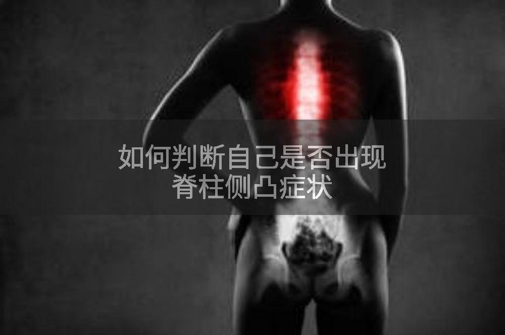 如何判断自己是否出现脊柱侧凸症状