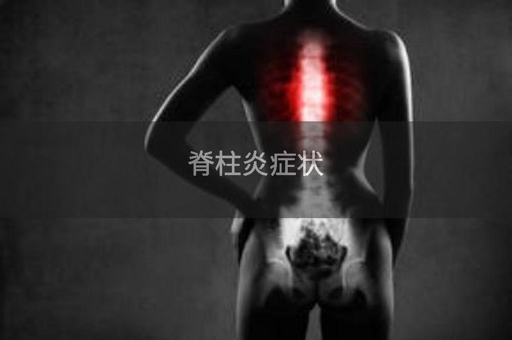 脊柱炎症状