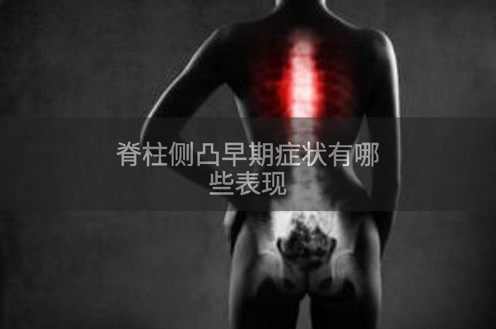脊柱侧凸早期症状有哪些表现