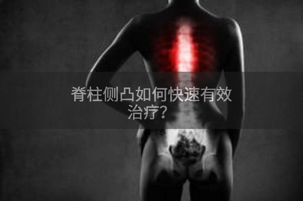 脊柱侧凸如何快速有效治疗？