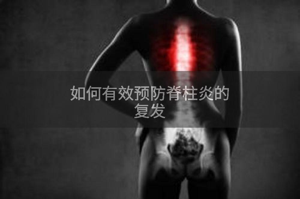 如何有效预防脊柱炎的复发