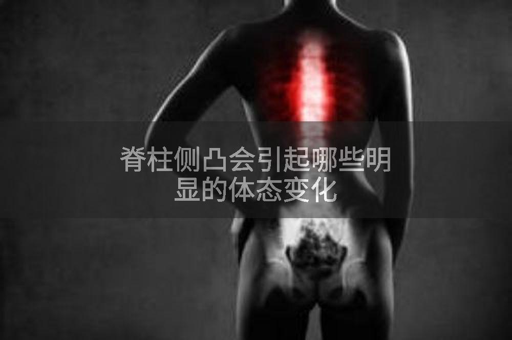 脊柱侧凸会引起哪些明显的体态变化