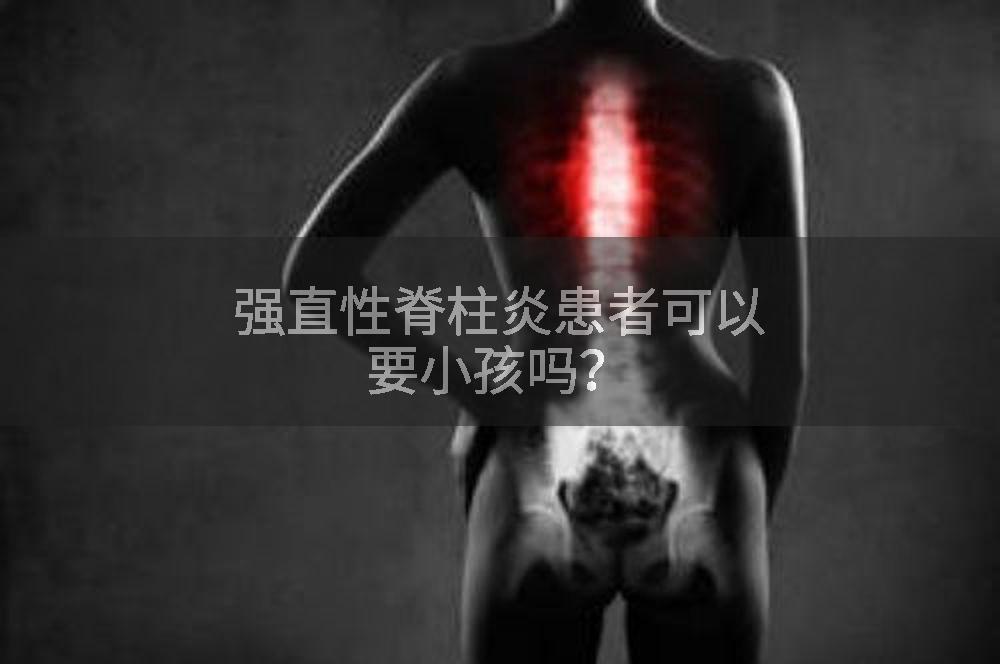 强直性脊柱炎患者可以要小孩吗？