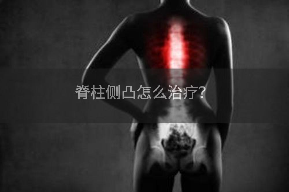 脊柱侧凸怎么治疗？
