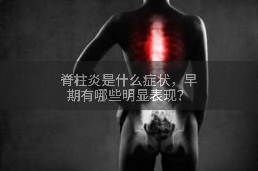 脊柱炎是什么症状，早期有哪些明显表现？