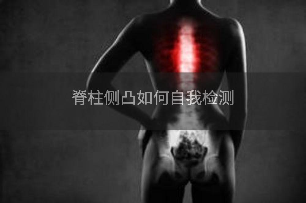 脊柱侧凸如何自我检测