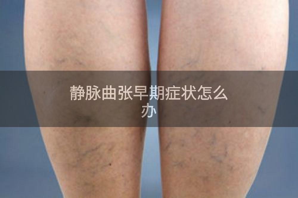 静脉曲张早期症状怎么办