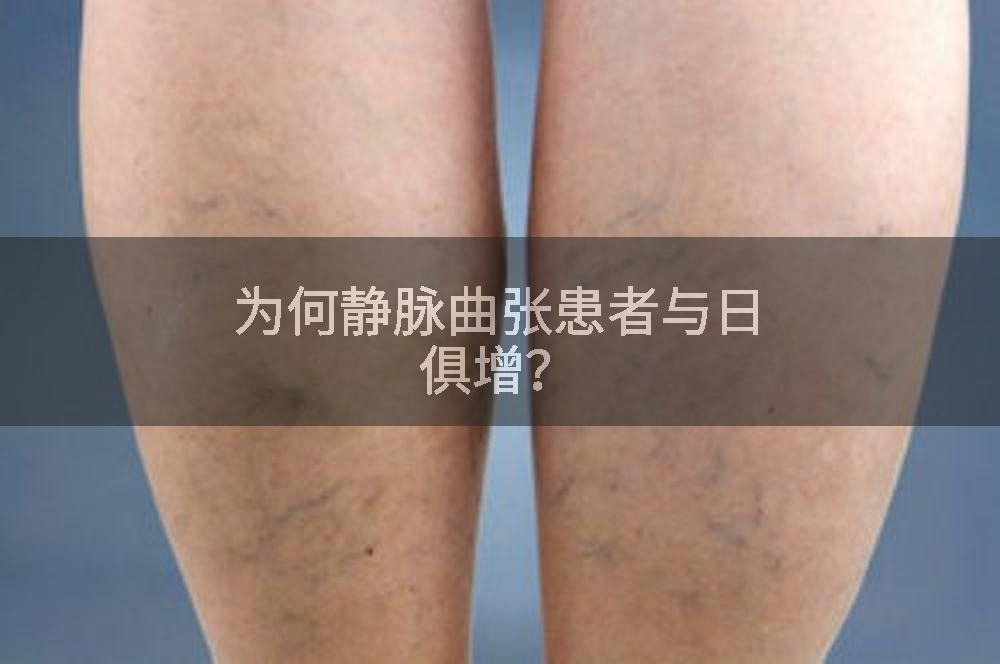 为何静脉曲张患者与日俱增？