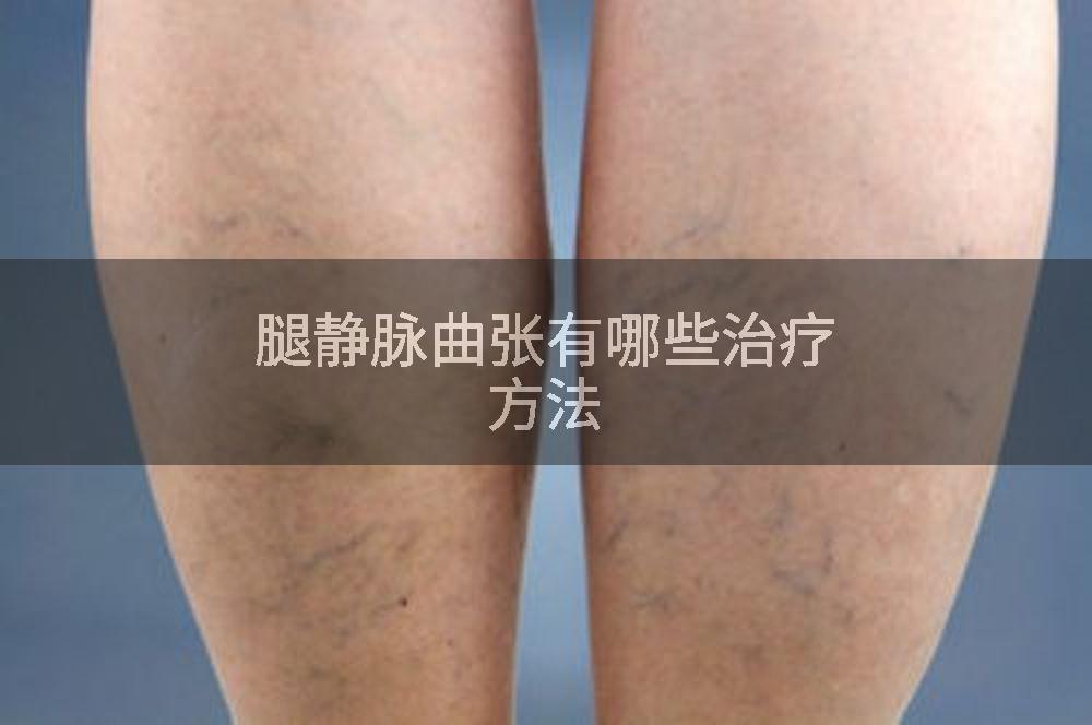 腿静脉曲张有哪些治疗方法