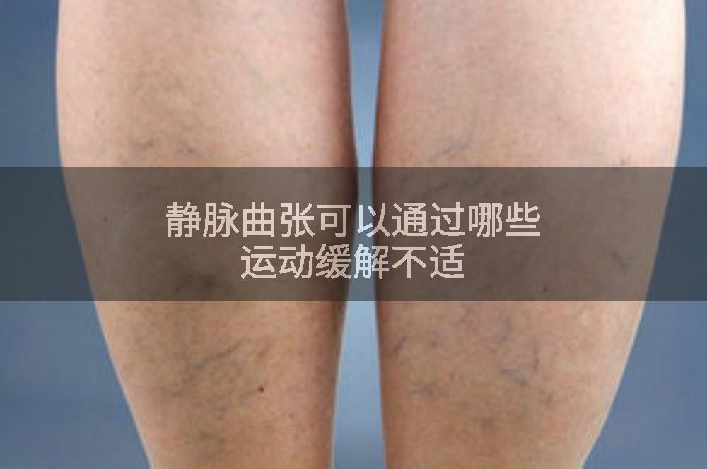 静脉曲张可以通过哪些运动缓解不适