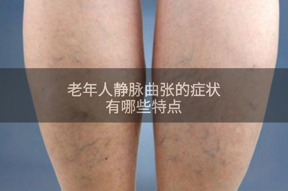 老年人静脉曲张的症状有哪些特点