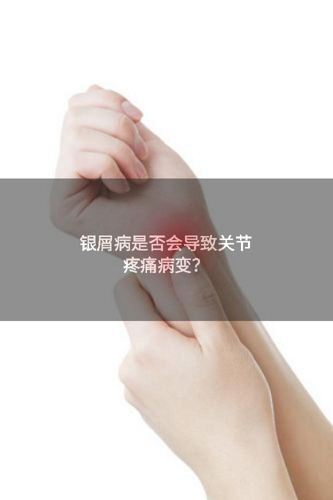 银屑病是否会导致关节疼痛病变？