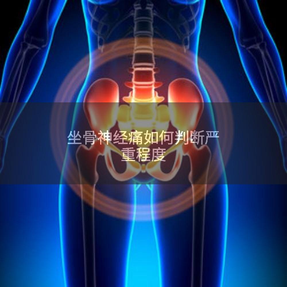 坐骨神经痛如何判断严重程度
