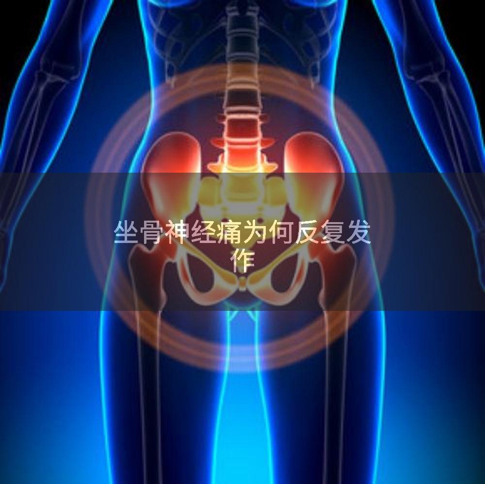 坐骨神经痛为何反复发作