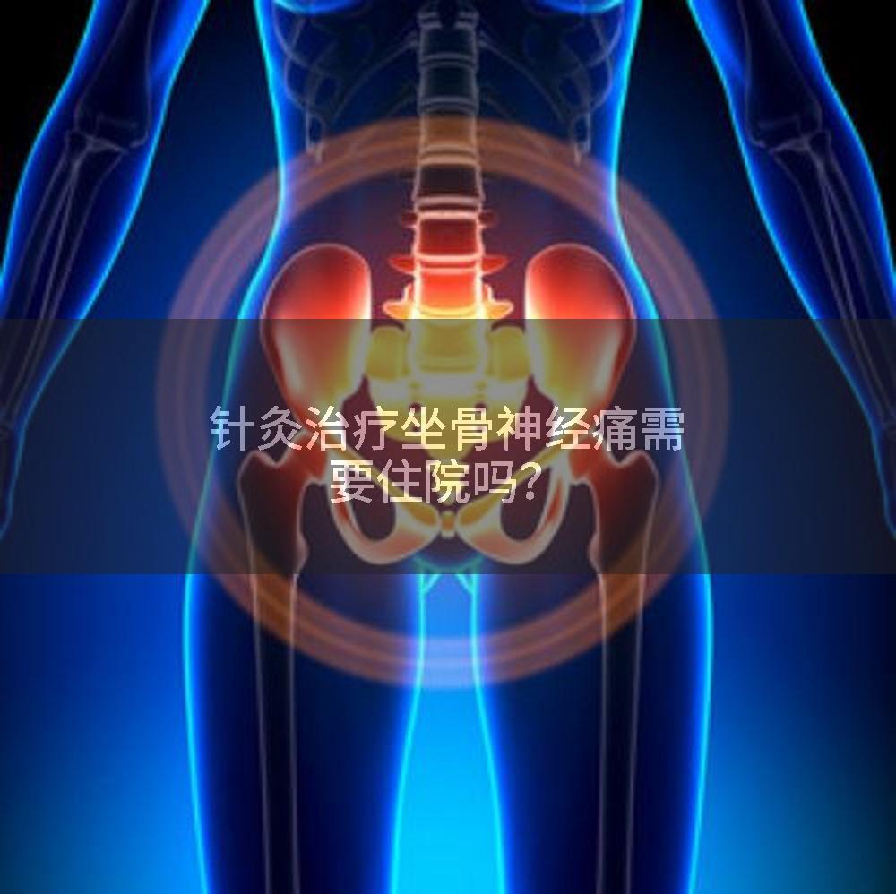 针灸治疗坐骨神经痛需要住院吗？