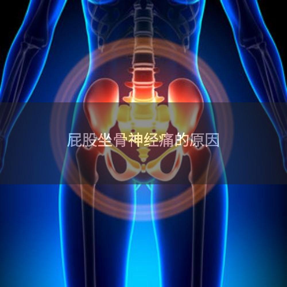 屁股坐骨神经痛的原因