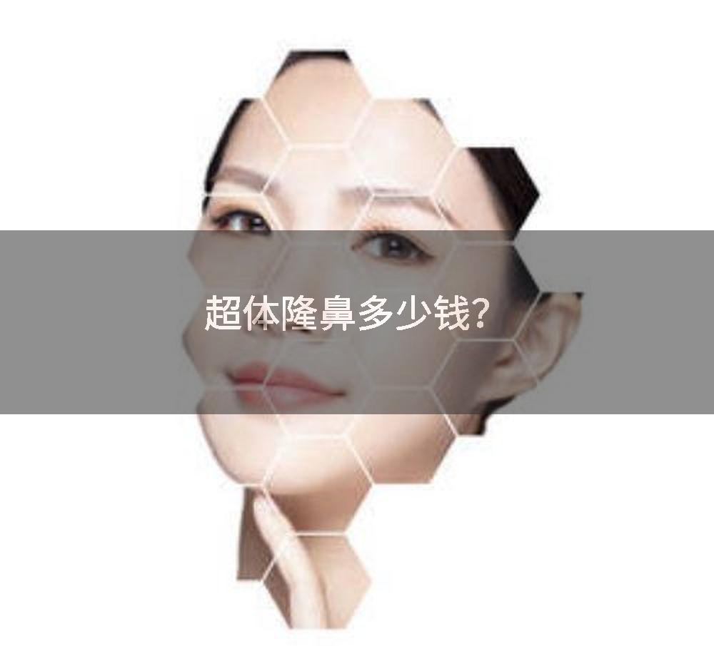 超体隆鼻多少钱？