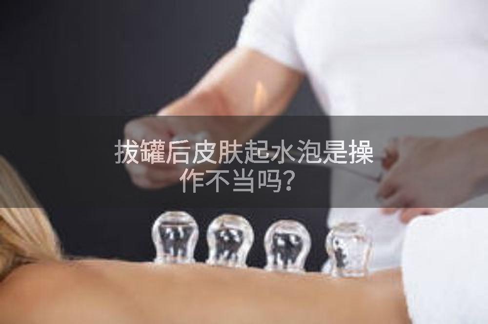 拔罐后皮肤起水泡是操作不当吗？