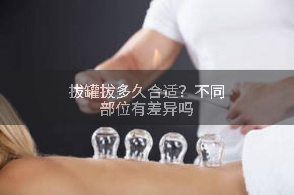 拔罐拔多久合适？不同部位有差异吗