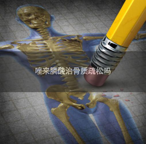 唑来膦酸治骨质疏松吗