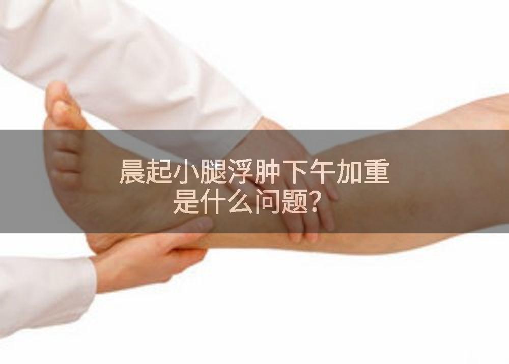 晨起小腿浮肿下午加重是什么问题？