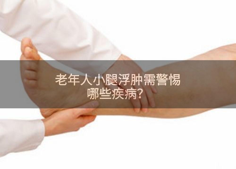 老年人小腿浮肿需警惕哪些疾病？