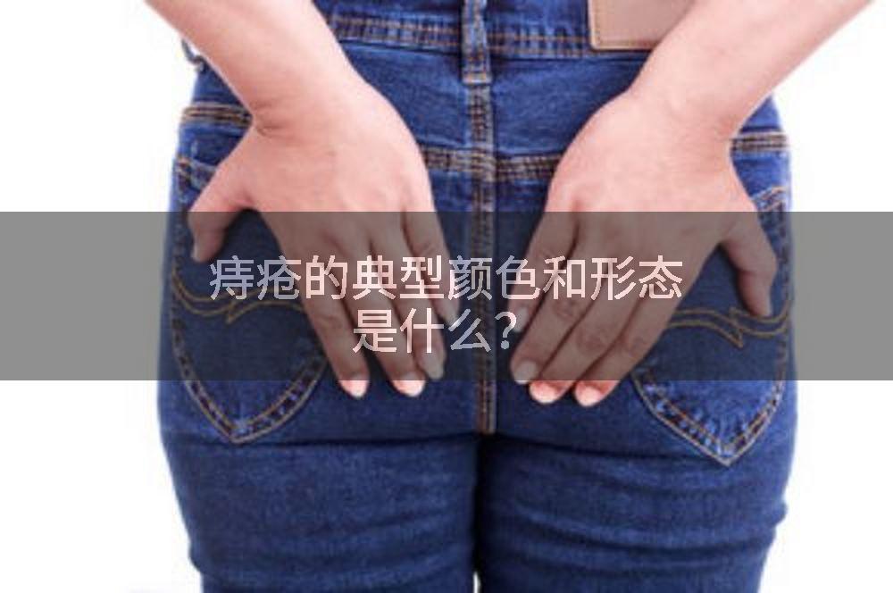 痔疮的典型颜色和形态是什么？