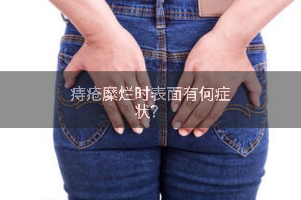 痔疮糜烂时表面有何症状？