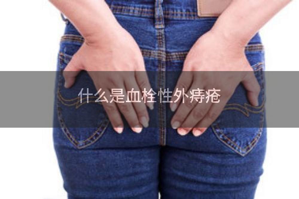 什么是血栓性外痔疮