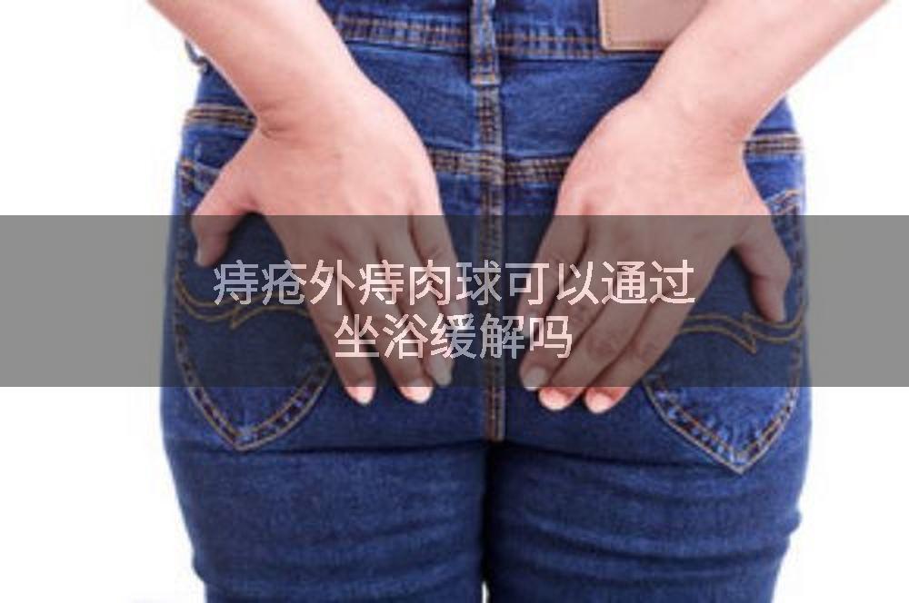 痔疮外痔肉球可以通过坐浴缓解吗