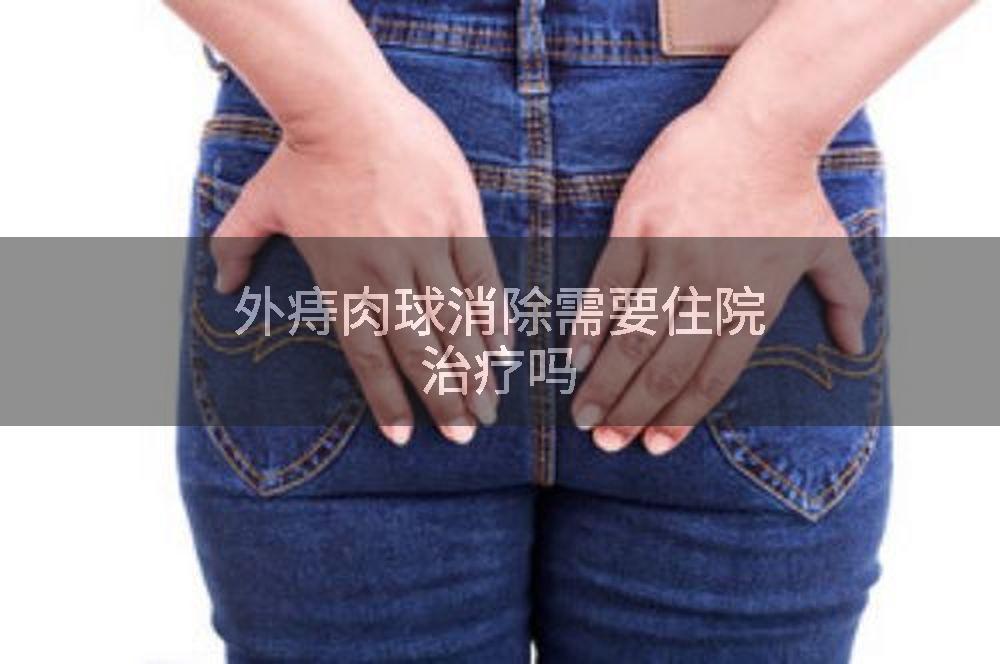 外痔肉球消除需要住院治疗吗