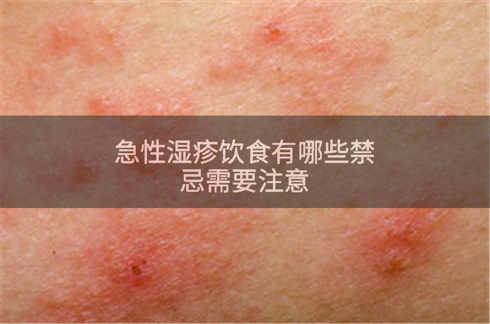 急性湿疹饮食有哪些禁忌需要注意