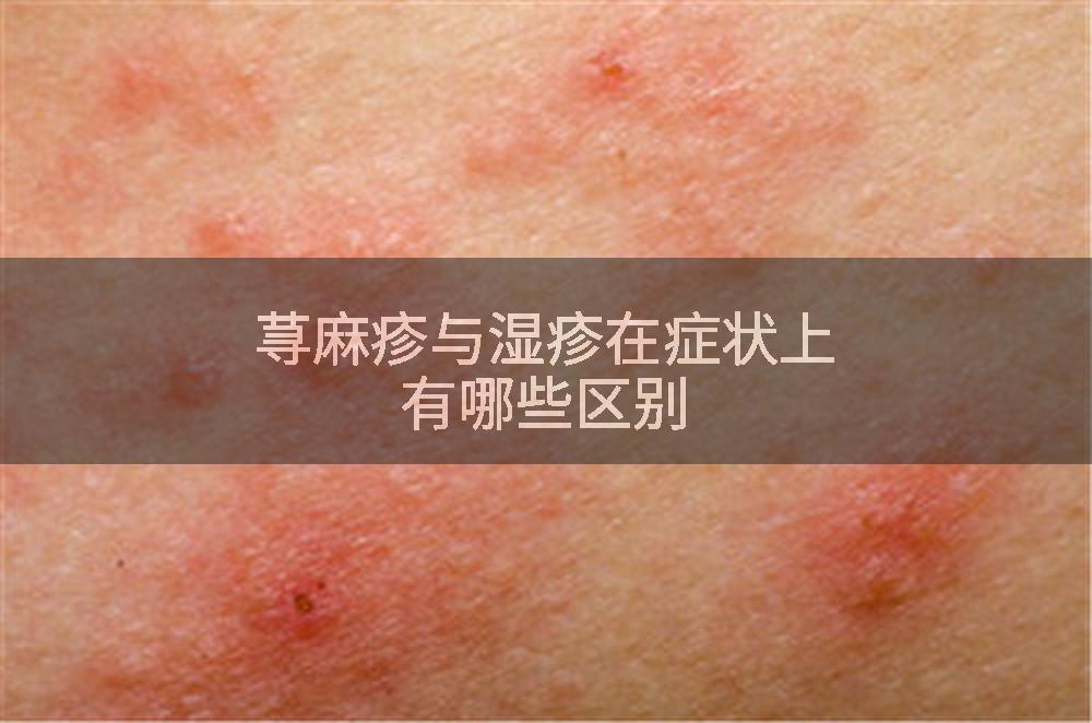 荨麻疹与湿疹在症状上有哪些区别