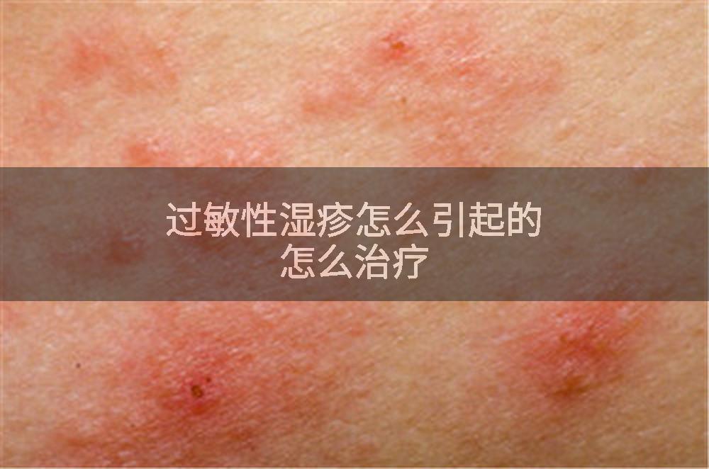 过敏性湿疹怎么引起的怎么治疗
