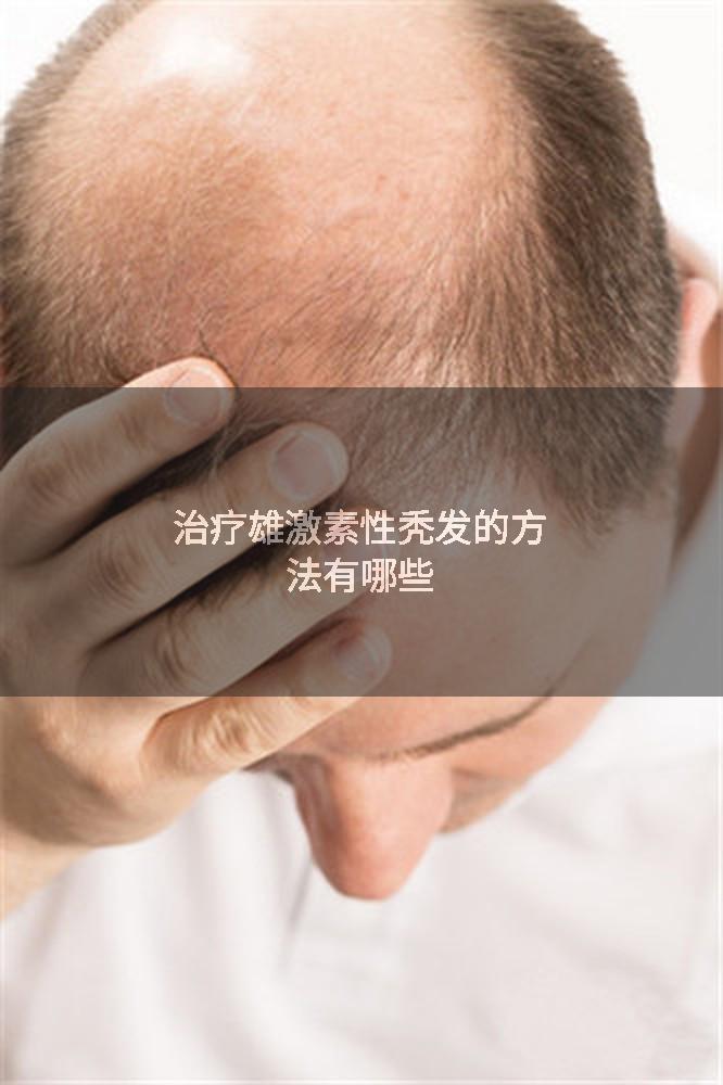 治疗雄激素性秃发的方法有哪些