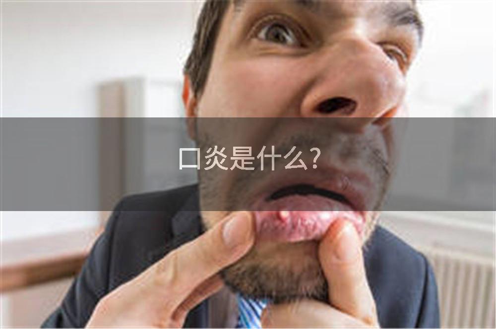口炎是什么?