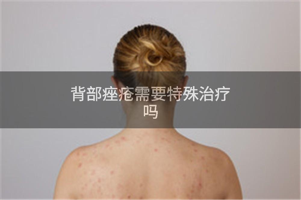 背部痤疮需要特殊治疗吗