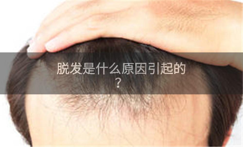 脱发是什么原因引起的？