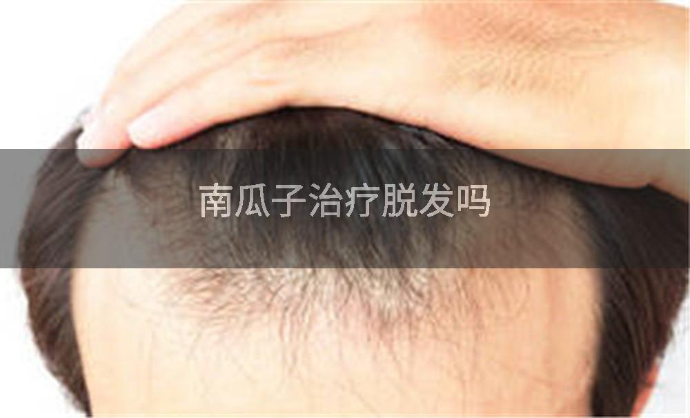 南瓜子治疗脱发吗