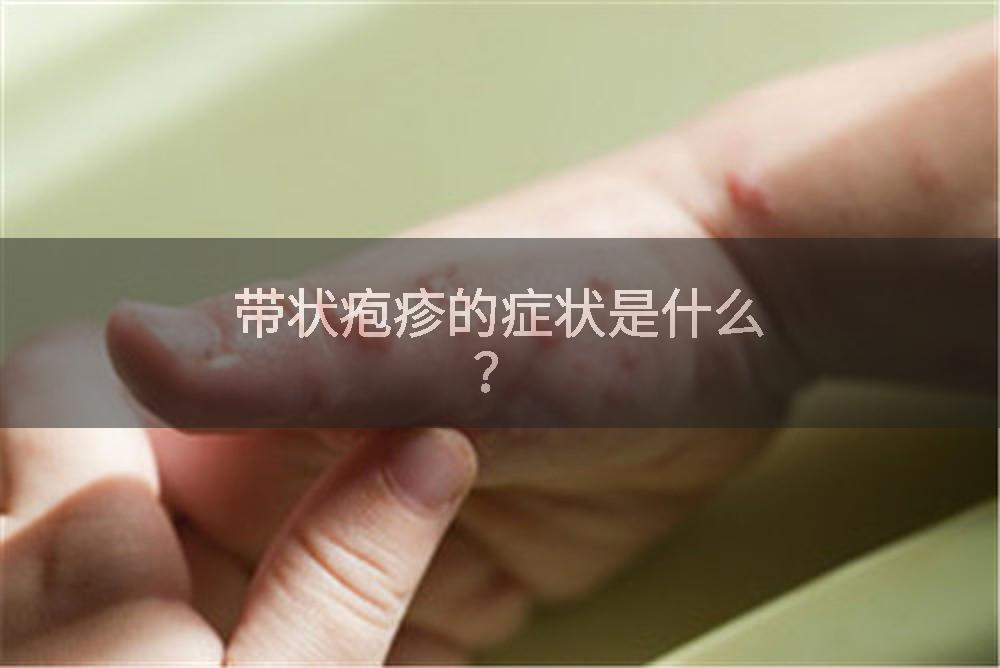 带状疱疹的症状是什么？