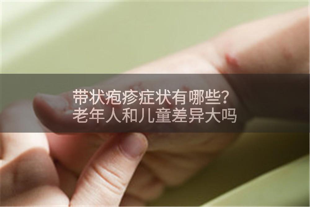 带状疱疹症状有哪些？老年人和儿童差异大吗
