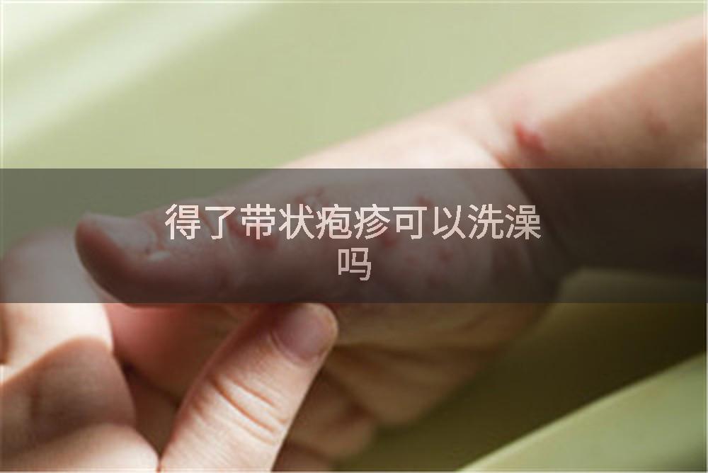 得了带状疱疹可以洗澡吗